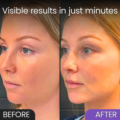 Velara – Firming Face Sculptor
